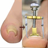 http://www.priyomarket.com/নখের কোনা সোজা করার অত্যাধুনিক যন্ত্র ( Nail Repair